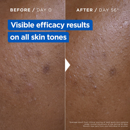 Mixa Niacinamide Bright, crème hydratation intense anti-taches brunes